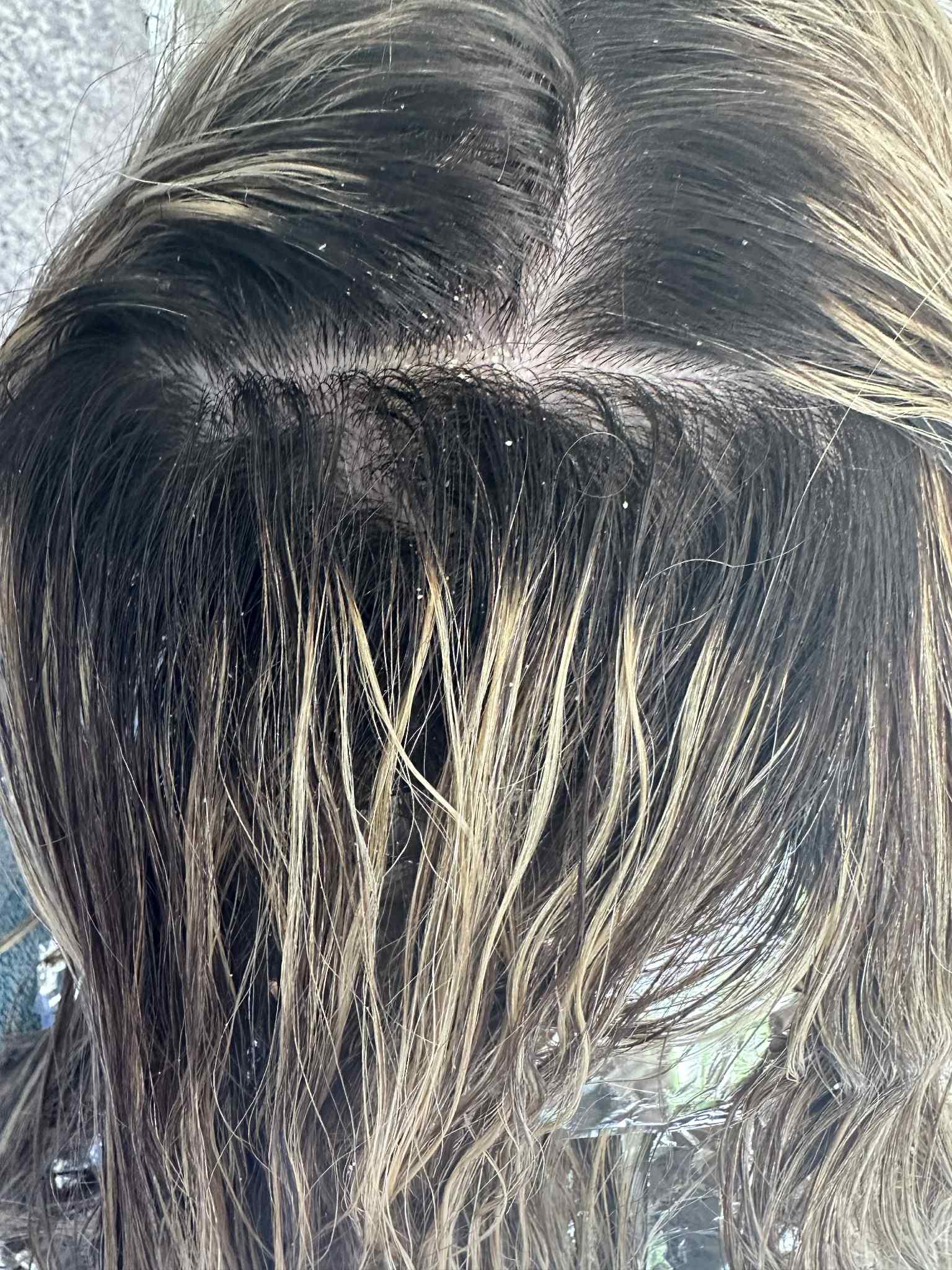 Close-up of hair with a focus on dandruff before and after