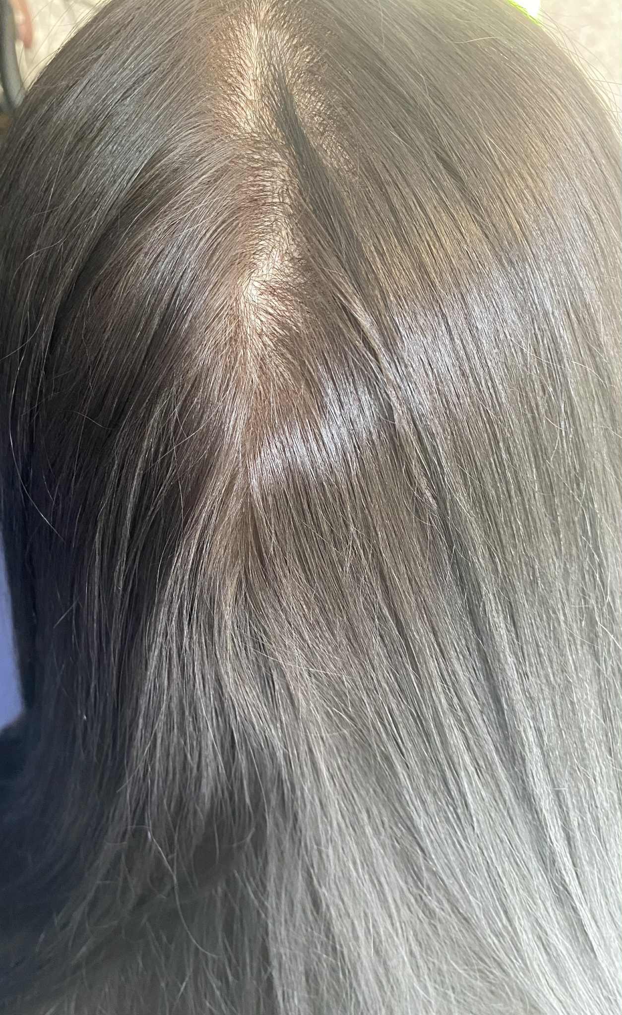 Close-up of hair with a focus on dandruff before and after