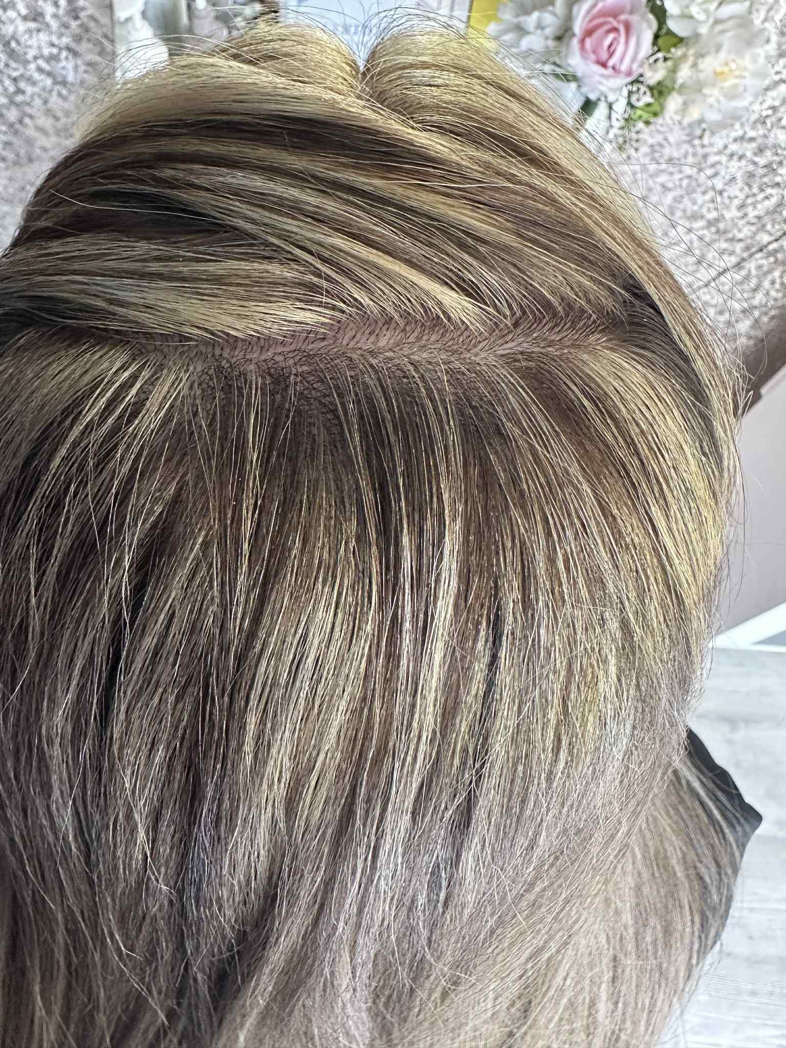 Close-up of hair with a focus on dandruff before and after